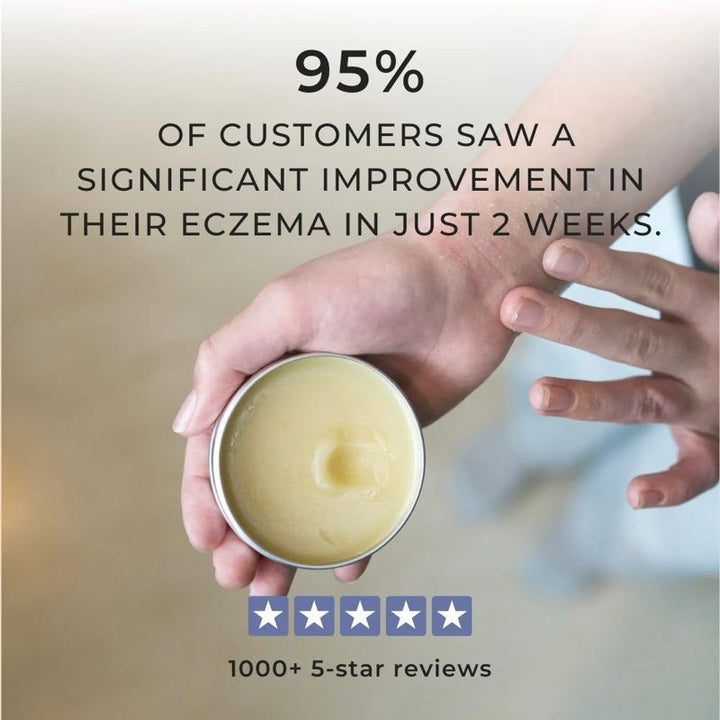 IMGSven's Island Miracle Manuka - 5 Star Reviews with 55g cream and hand