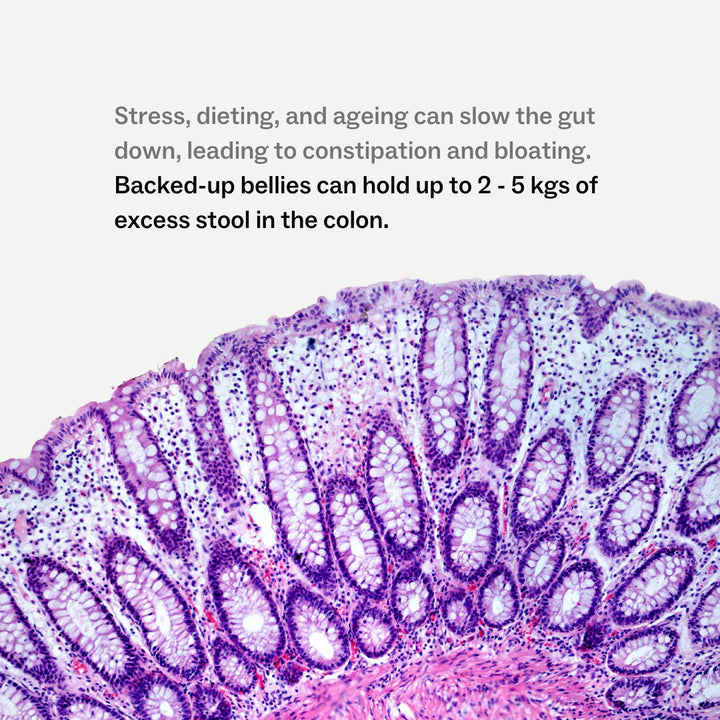 Microscopic view of intestinal tissue with text about constipation and bloating.