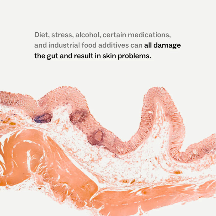 Microscopic view of gut lining with text about gut health and skin problems.